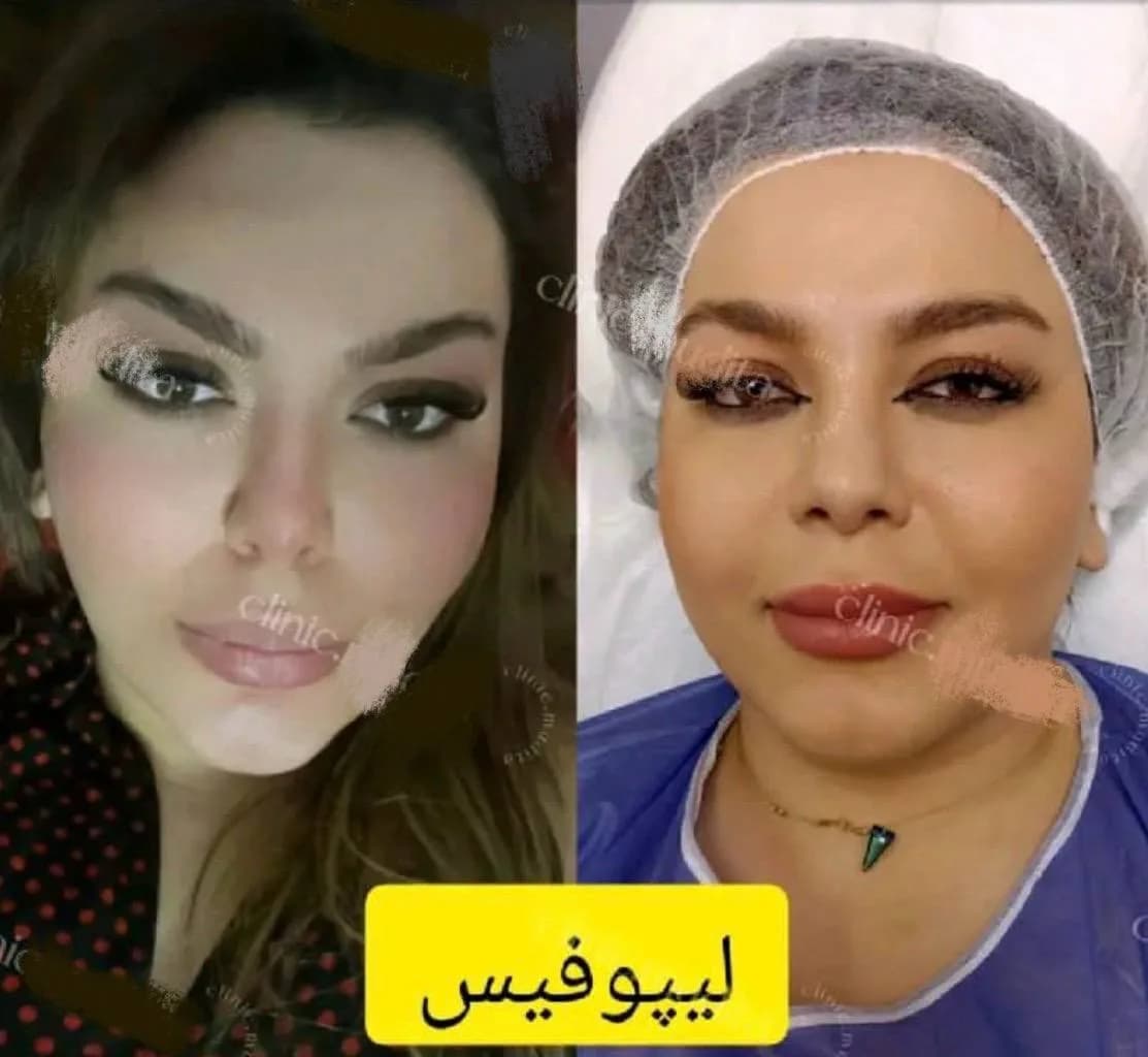 Parvan Beauty Clinic - 4
