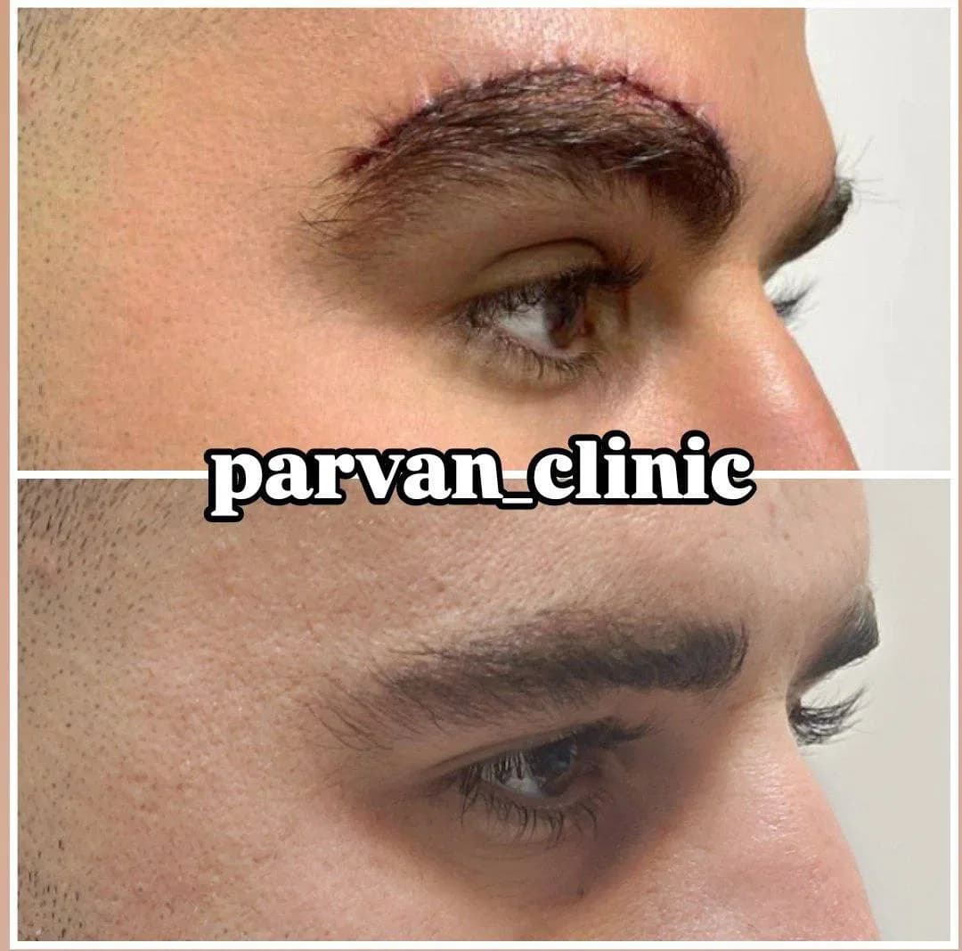 Parvan Beauty Clinic - 5