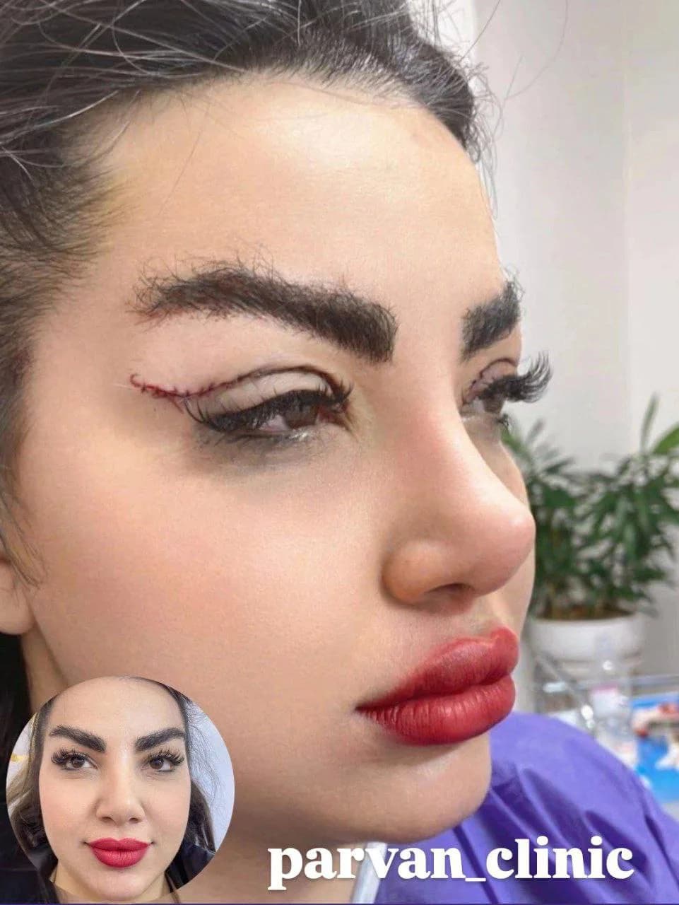 Parvan Beauty Clinic - 6